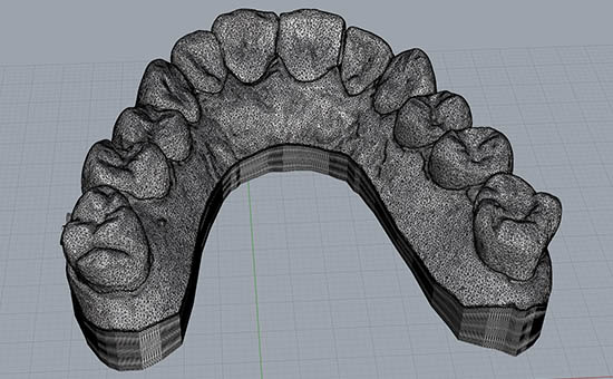 stampante 3d modelli dentali triangolazione mesh stl stratus dental 3d prototipazione