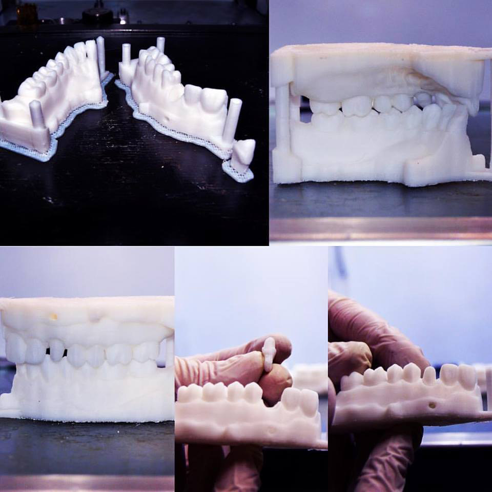 stratus dental 3d stampante 3d fdm settore dentale